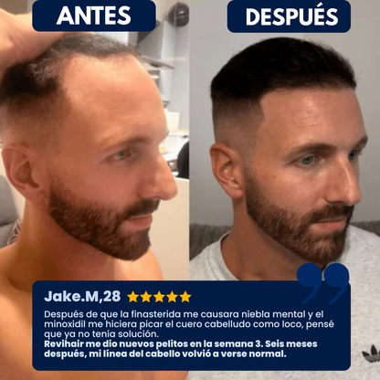 Revihair™: El sérum que está frenando la caída del cabello.