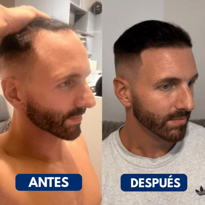 Revihair™ Roll-on de regeneración capilar